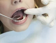 Как да извадите сами зъб
