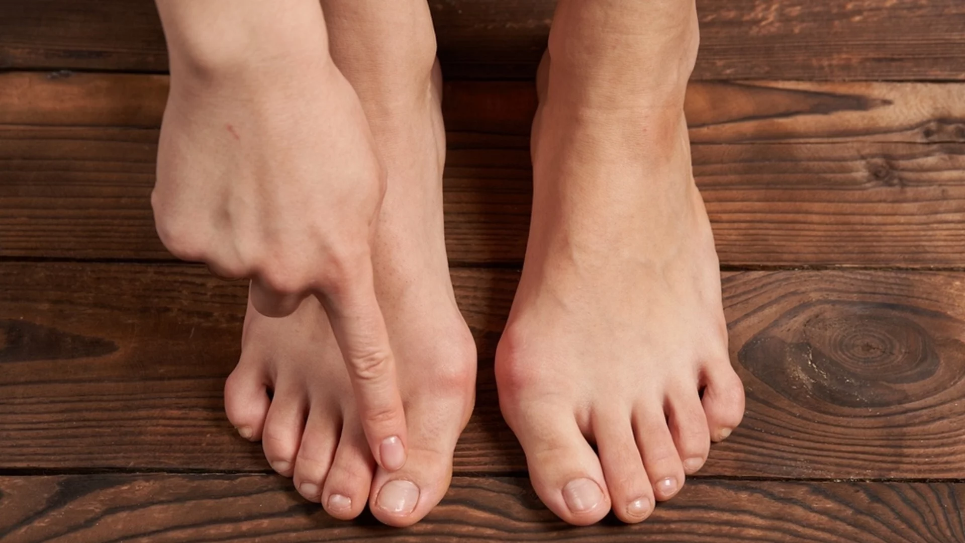Този симптом с пръстите на краката издава предстоящ инфаркт или инсулт