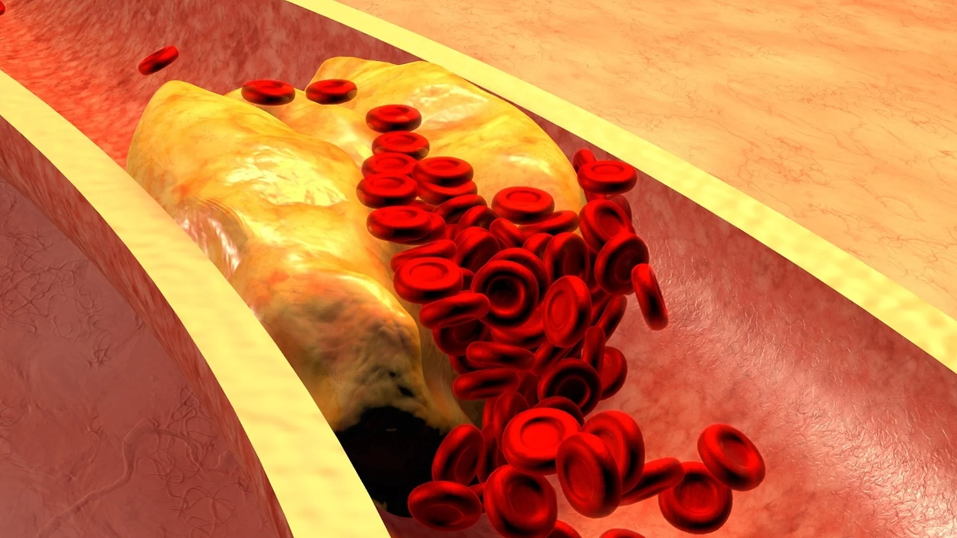 Лекар: Всеки човек над 60 години трябва да пие този сок за сваляне на холестерола