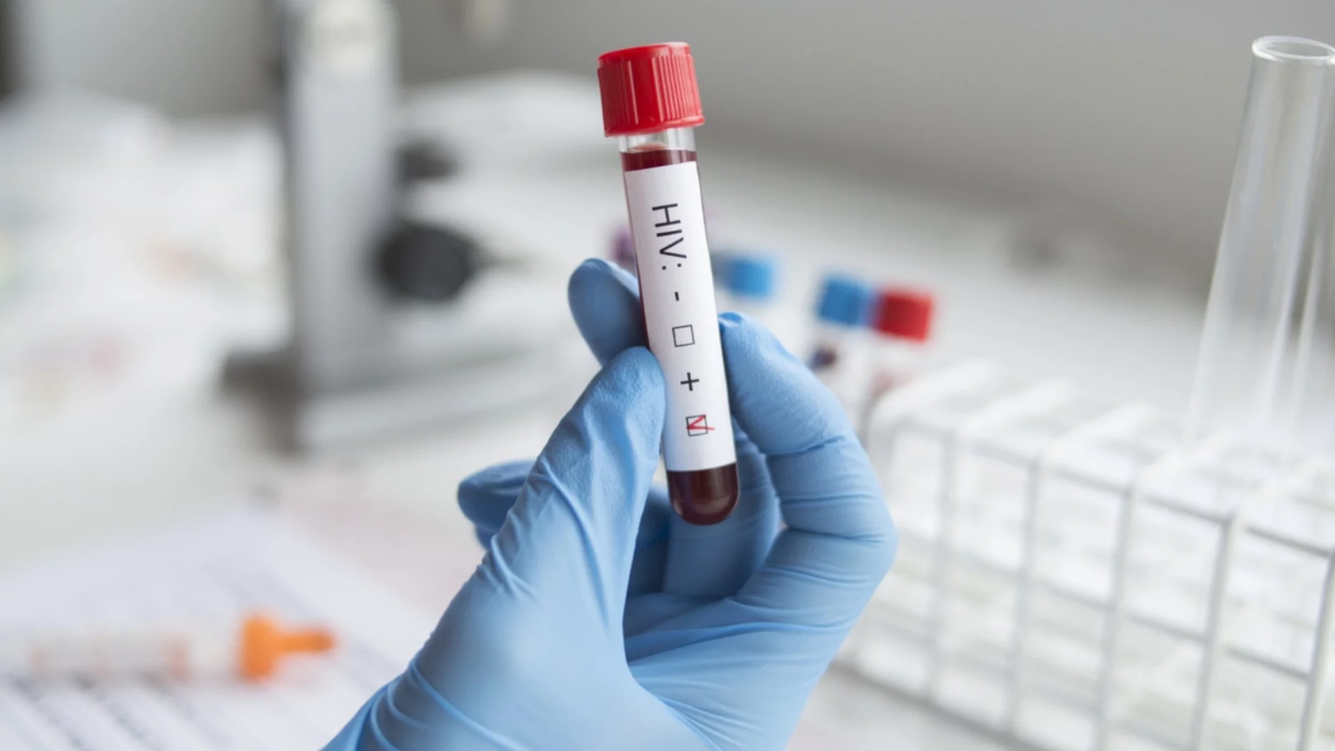 Нова надежда: Лекарство срещу СПИН с невероятни първи резултати