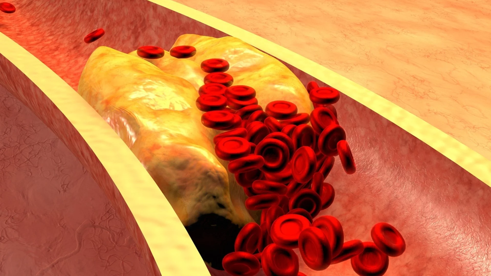 Лекар: Яжте този евтин зеленчук всеки ден, той сваля холестерола, здравен съвет за деня, 1 август