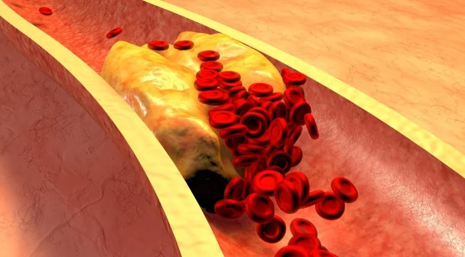 Кардиолог: Лошата страна на добрия холестерол - какви трябва да са стойностите му