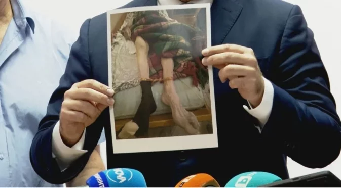 Ампутираха пръст на крака на жена от "Къщата на ужасите" в хосписа в Ягода