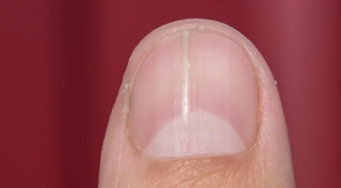 Какво казва полумесецът на ноктите ви: От бъбречни до сърдечни проблеми