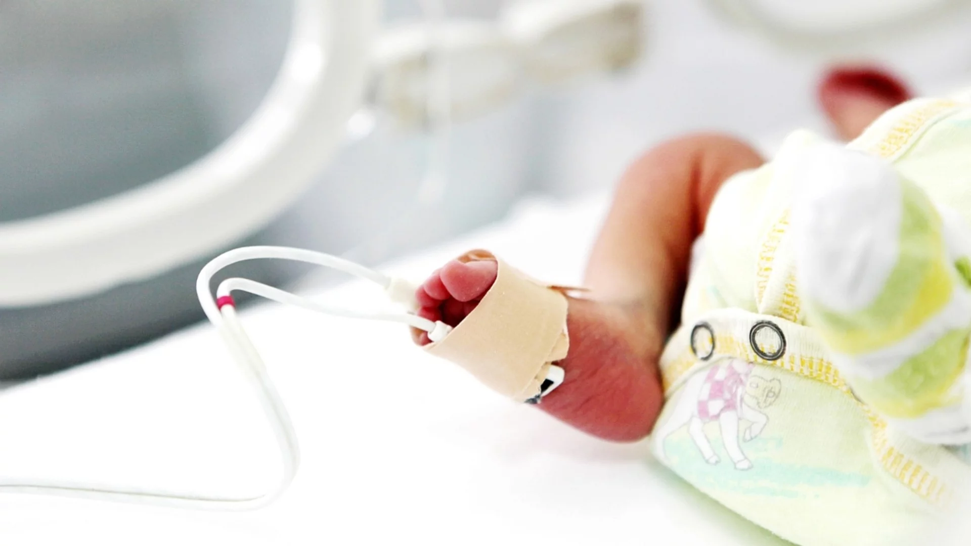 Чудо в медицината: Лекари спасиха 300-грамово новородено момиченце