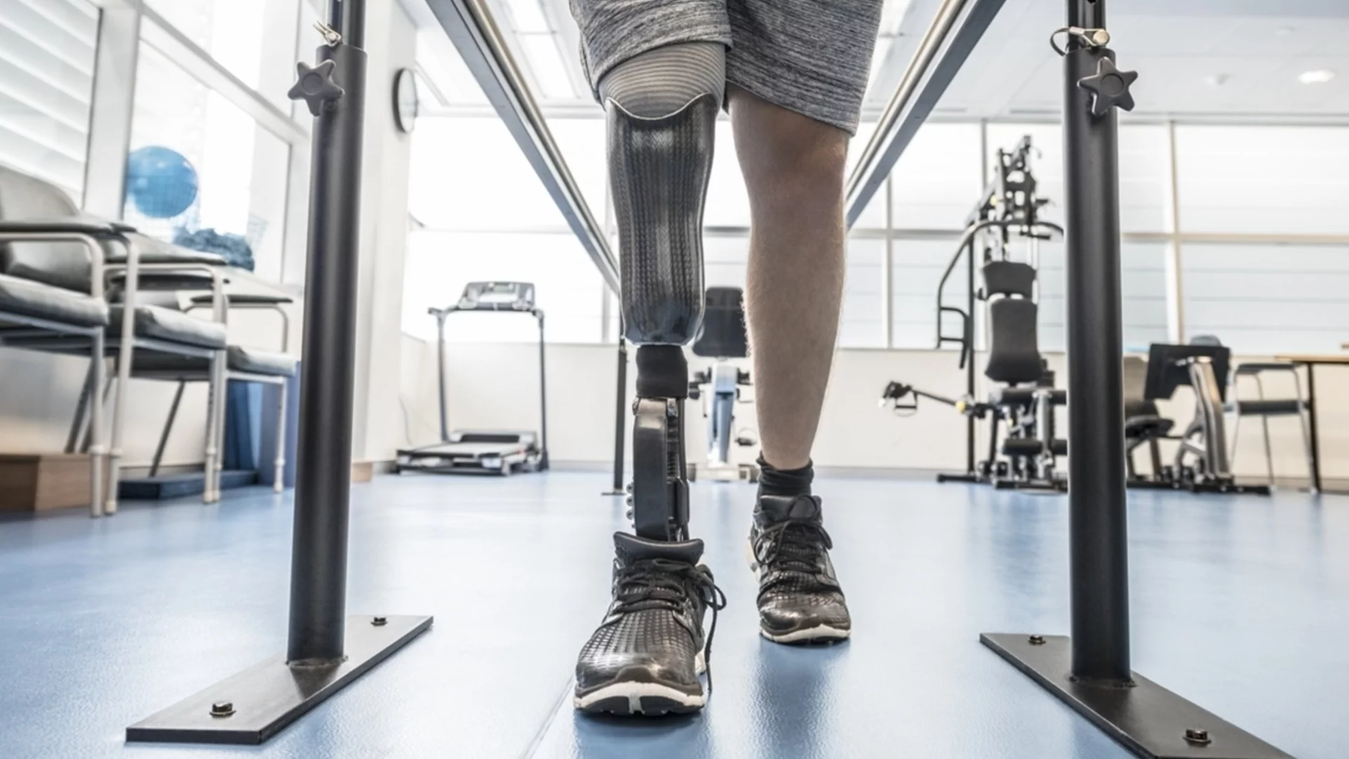 Русия увеличи драстично доставките на протези заради огромния брой инвалиди от фронта