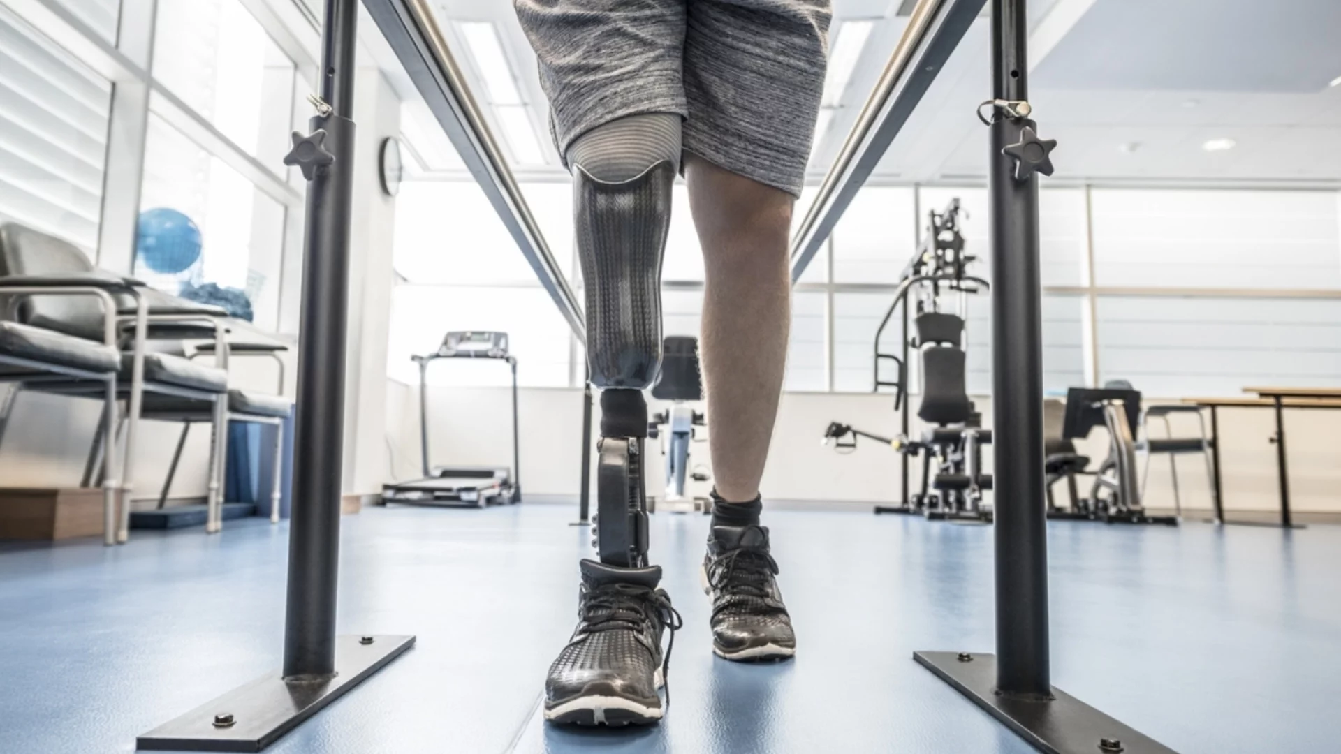 Над 50% от протезите за осакатените руски войници се купуват от "неприятелски страни"