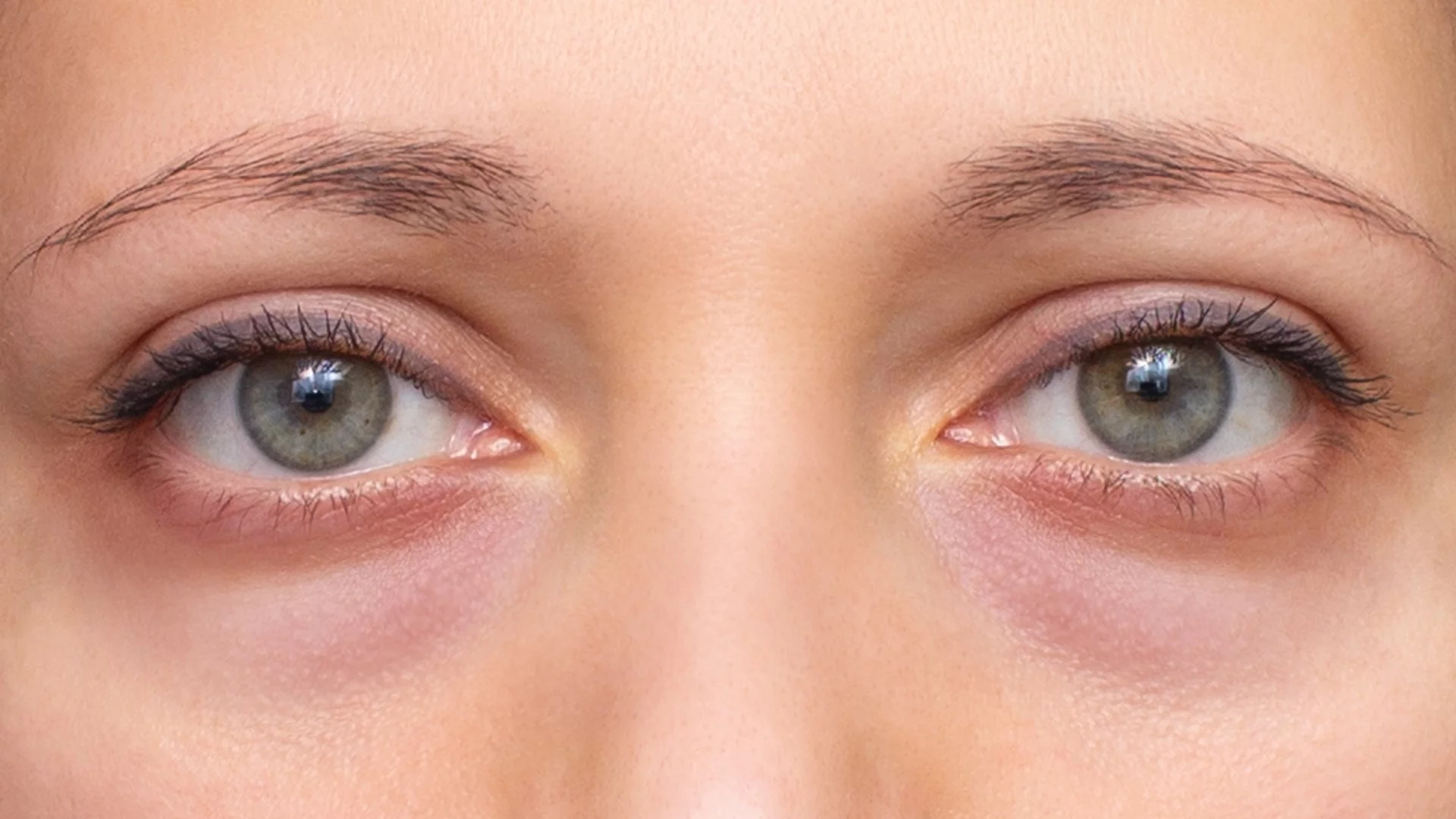 Знаете ли защо се получават сенки и торбички под очите?