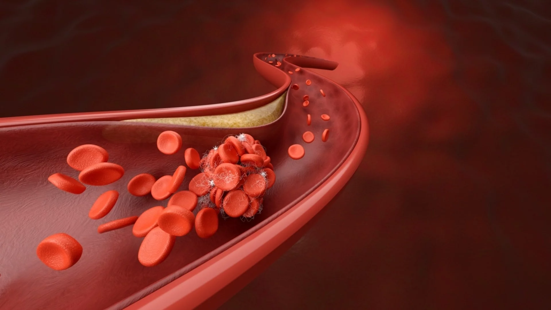 Топ 5 храни, които свалят холестерола и заменят месото на 100%