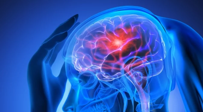 Популярен актьор и изпълнител е претърпял инсулт само на 41