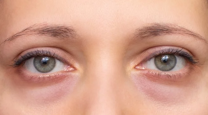 Какво означава бързото мигане при стрес или при лъжа