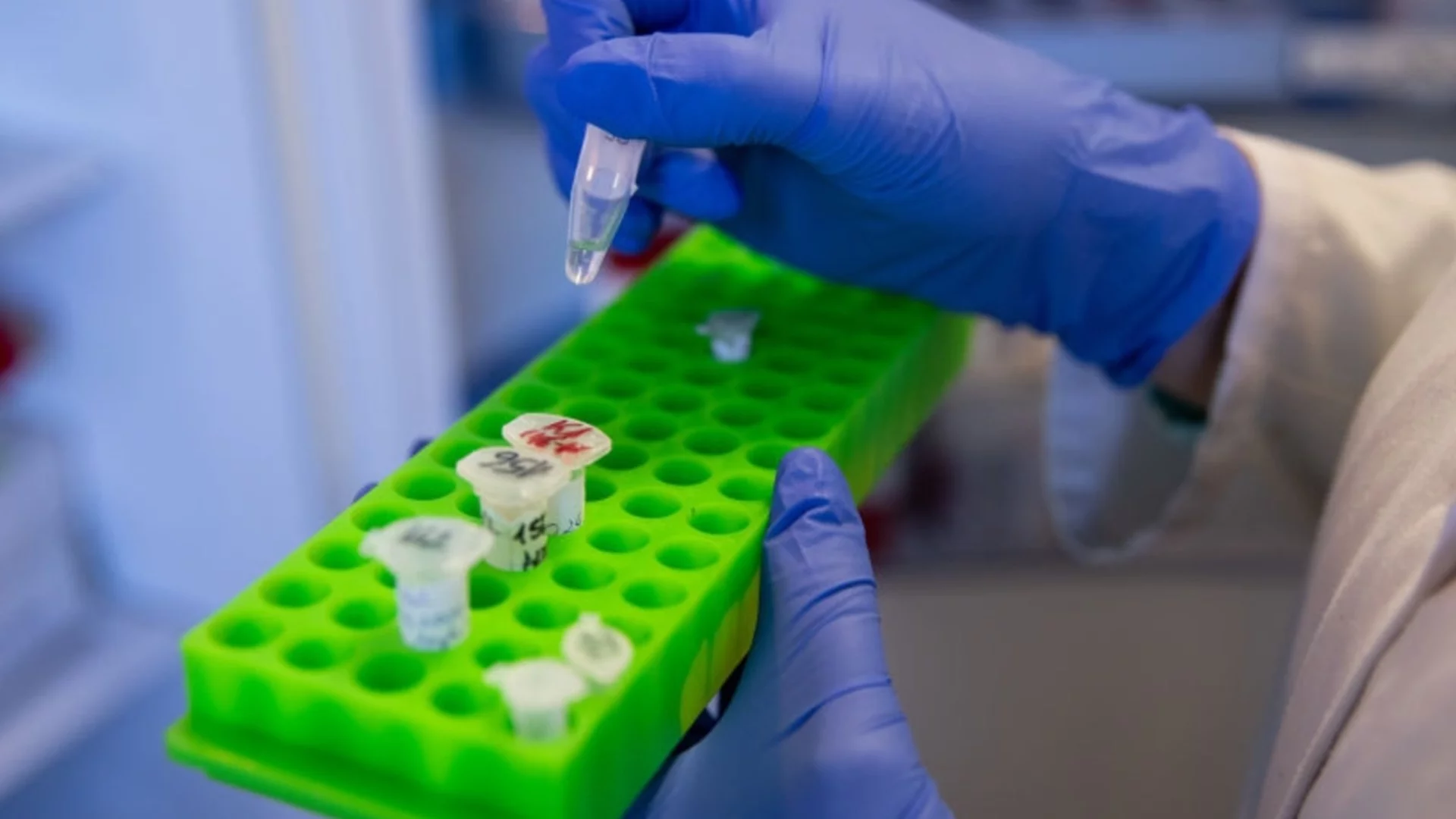 „Прегърбеният човек“ пристигна у нас: Първи потвърден случай на вируса чикунгуня в България