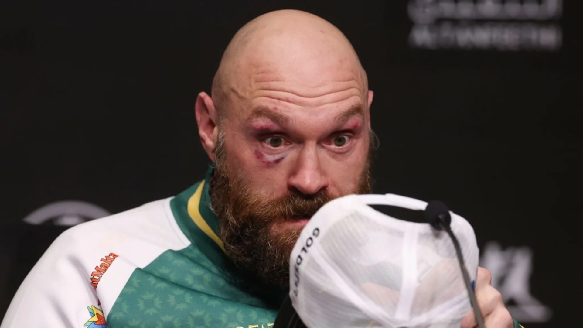 Официално: Ясно е кога Тайсън Фюри се завръща на ринга