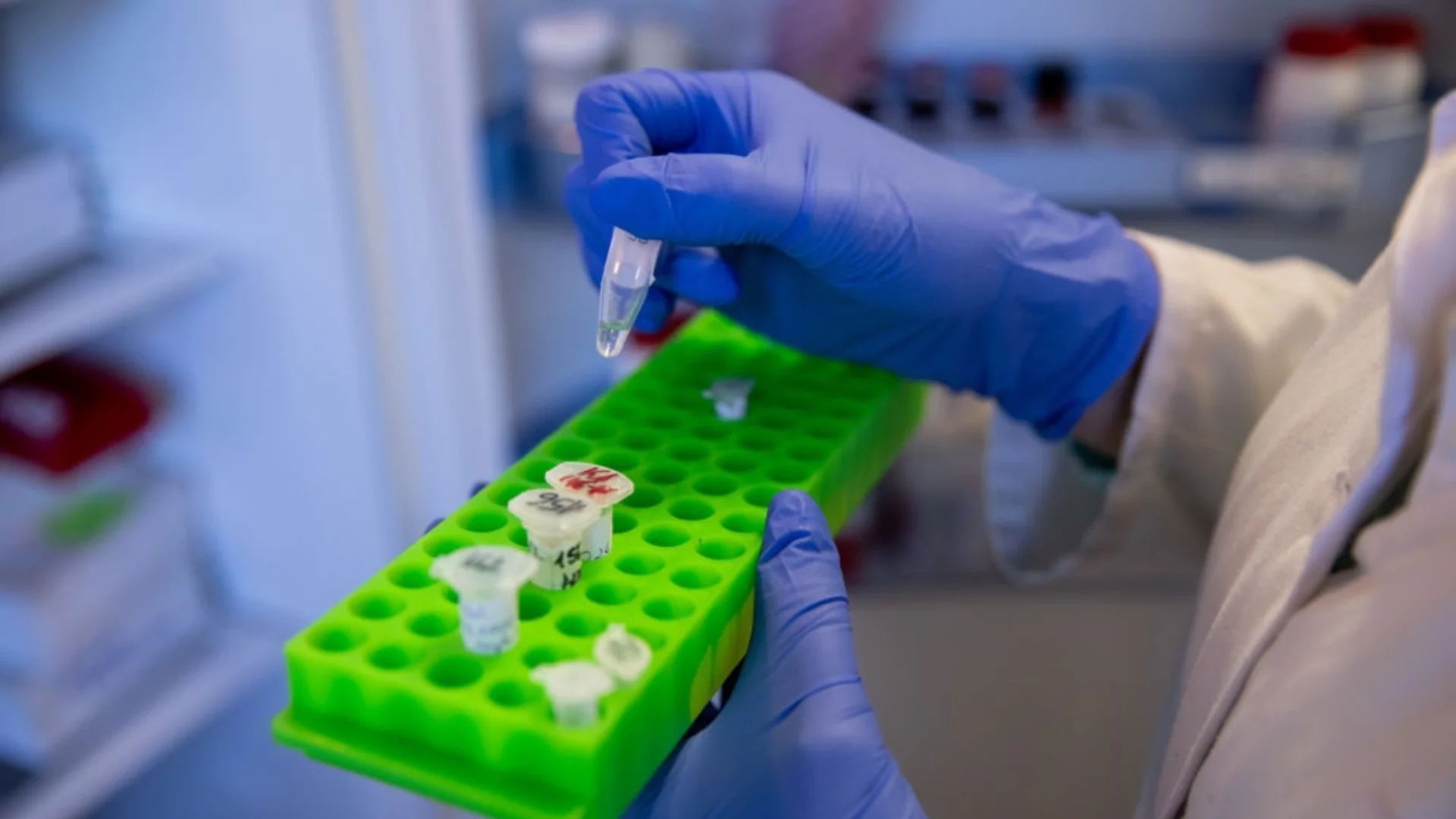 Мозъчни увреждания и гърчове: България следи смъртоносния вирус Нипа