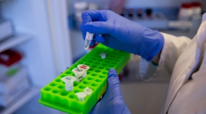 Мозъчни увреждания и гърчове: България следи смъртоносния вирус Нипа