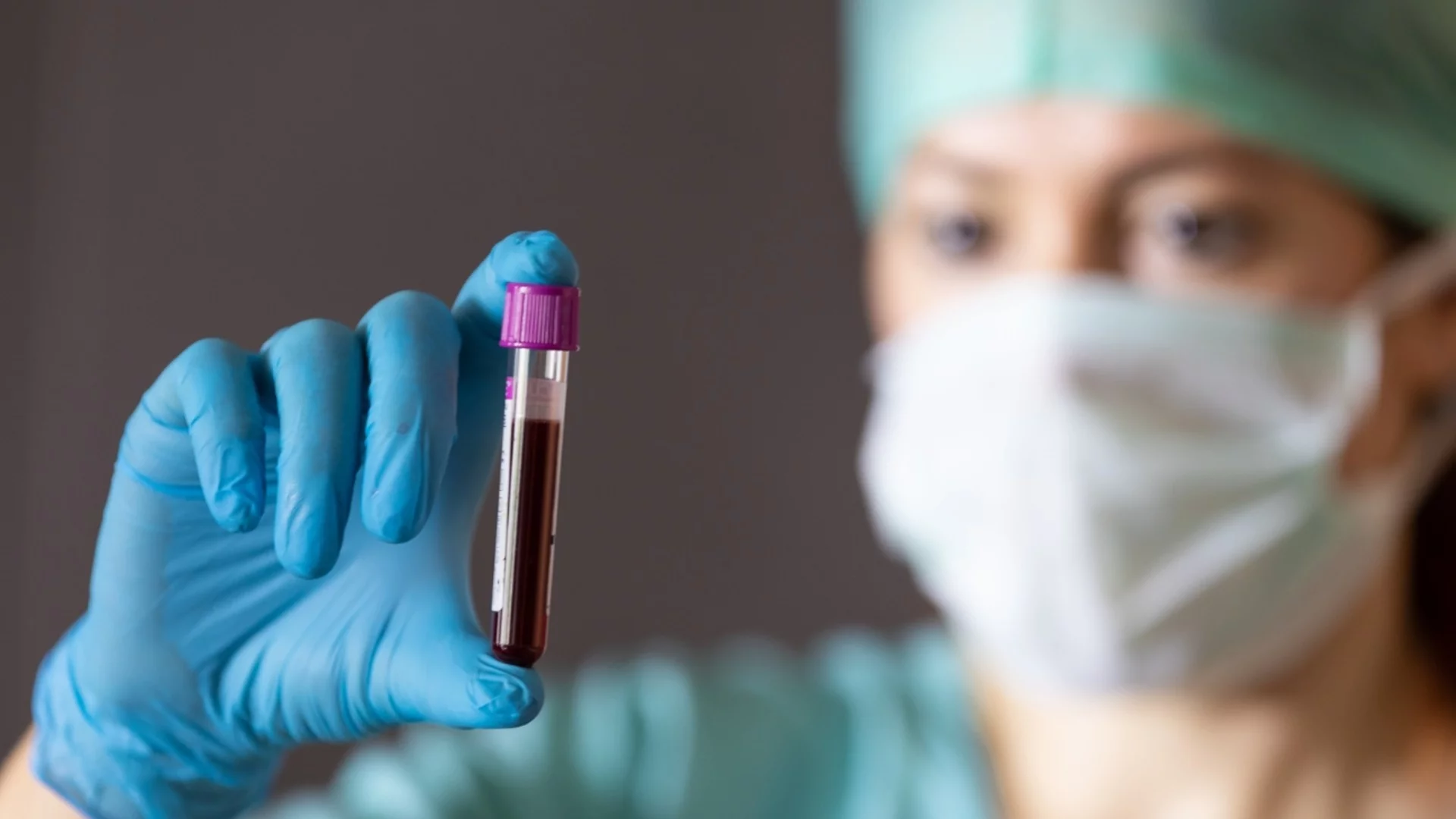 Правилото на трите единици: Лекар със съвет за Световния ден за борба с рака 