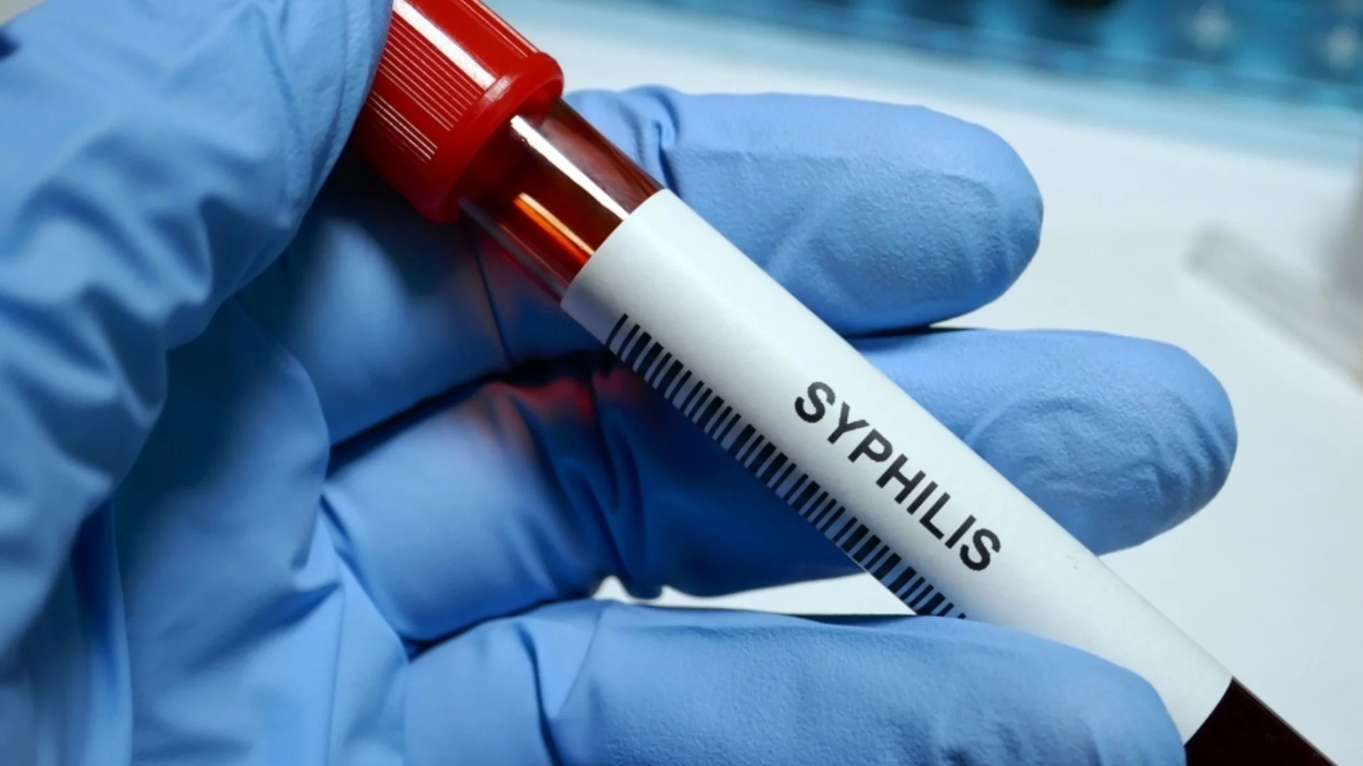 Презервативите са им скъпи: Рекорден ръст на сифилис в Русия