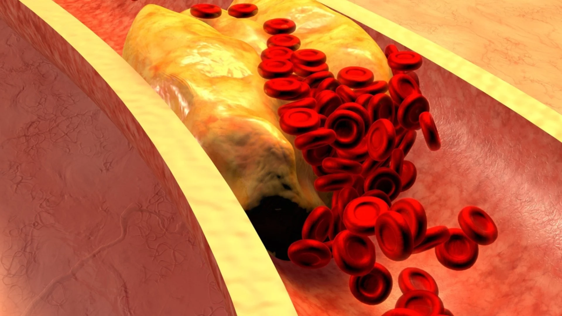 Храни, които понижават холестерола