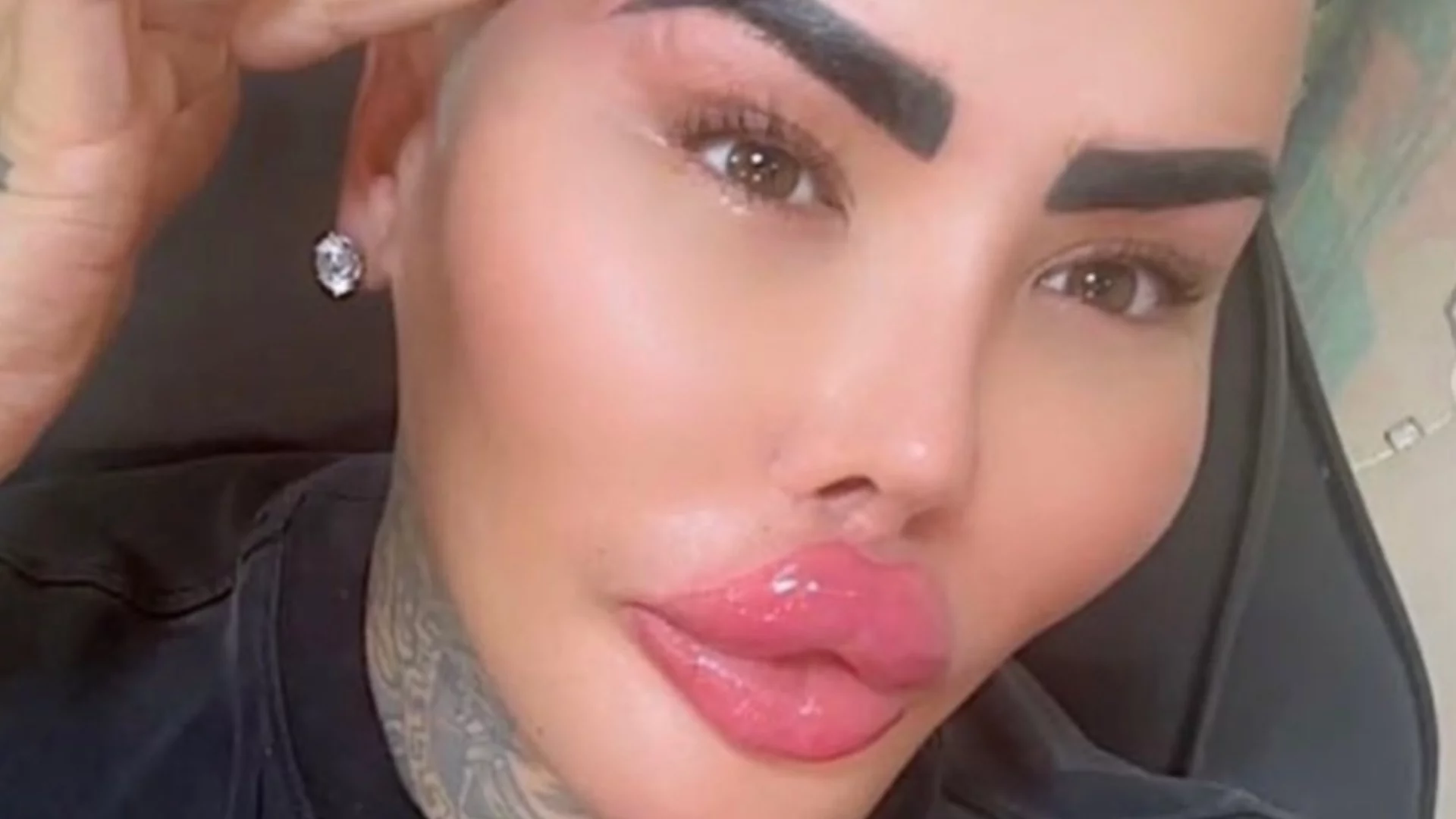 Кралят на силиконовите устни е открит мъртъв (СНИМКИ)