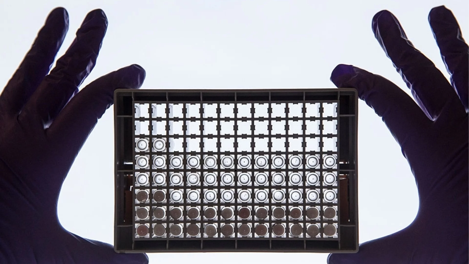 Потъват ли държавни пари: Завишени цени за тестове за рак, странна поръчка и любопитни имена