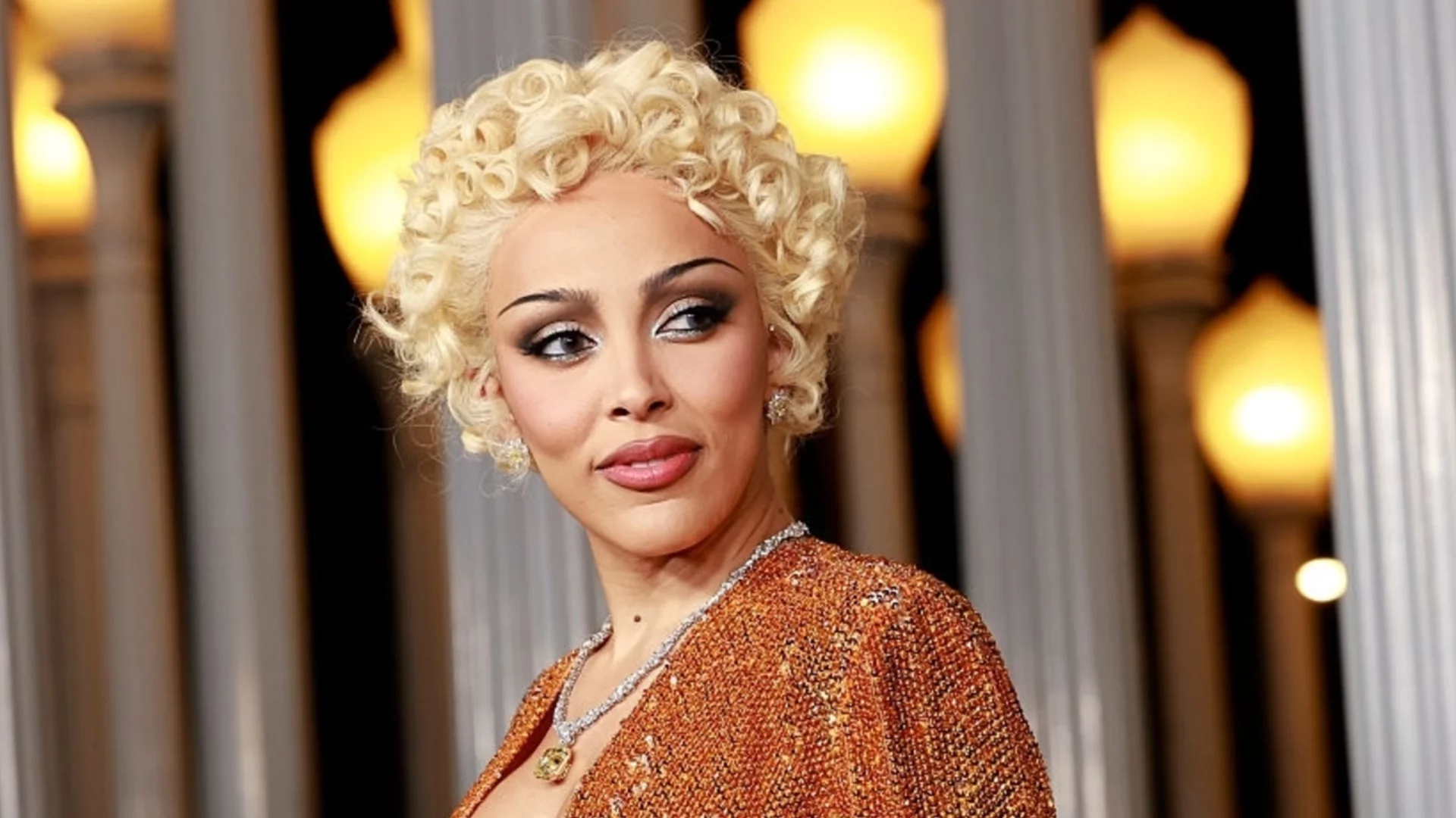 Певицата Дожа Кет се бори с тежък здравословен проблем (ВИДЕО)