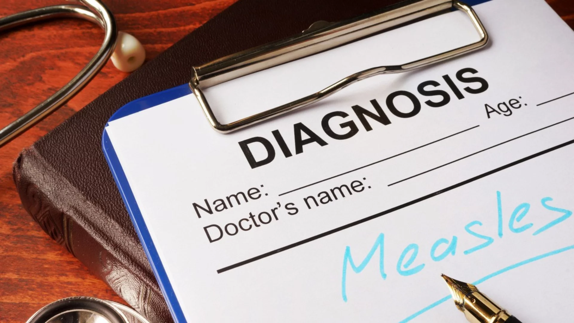 Расте броят на болните от морбили в област Враца