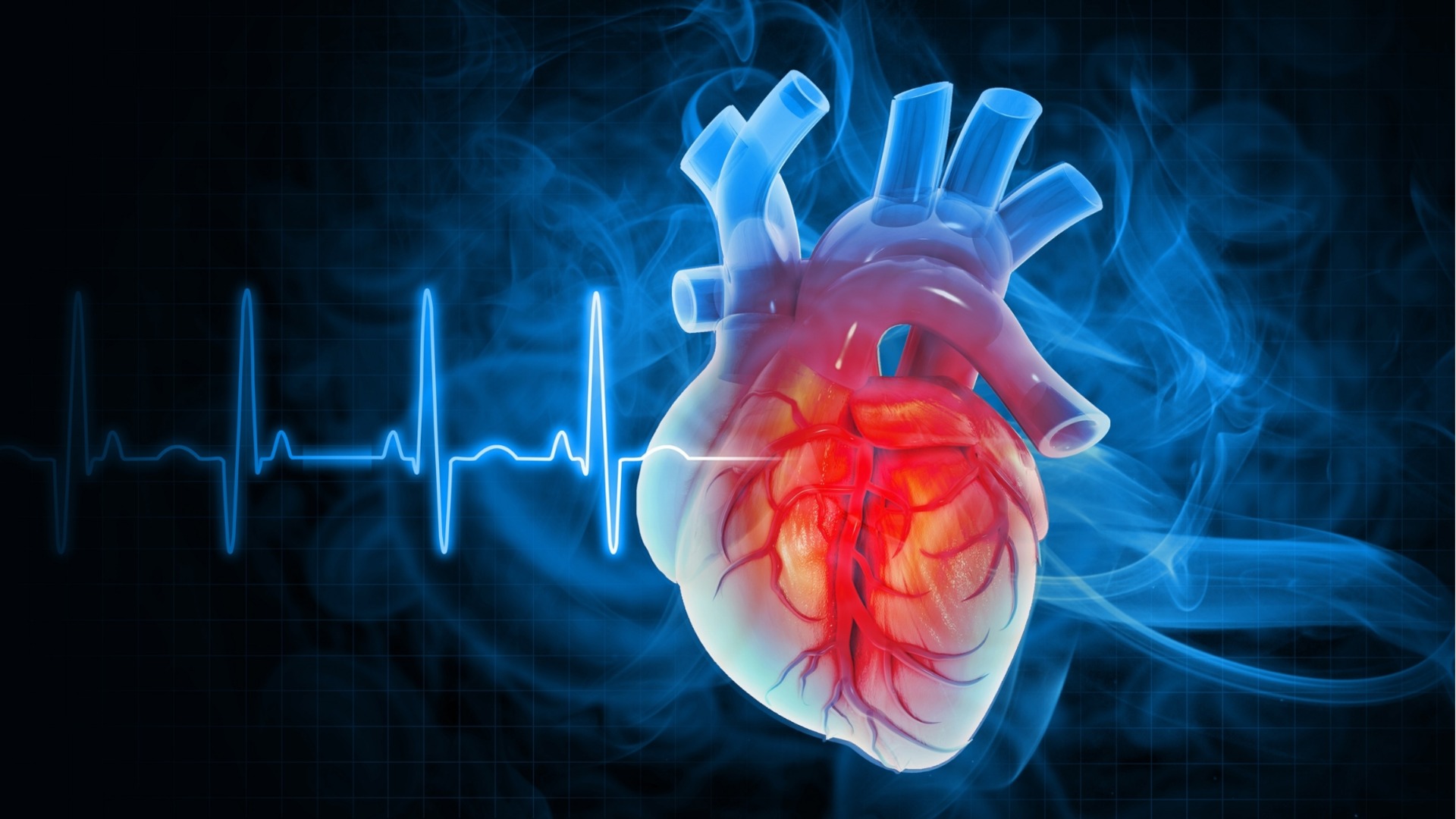 Първи сме в ЕС по сърдечно-съдова смъртност, почти 1/3 от българите са с високо кръвно