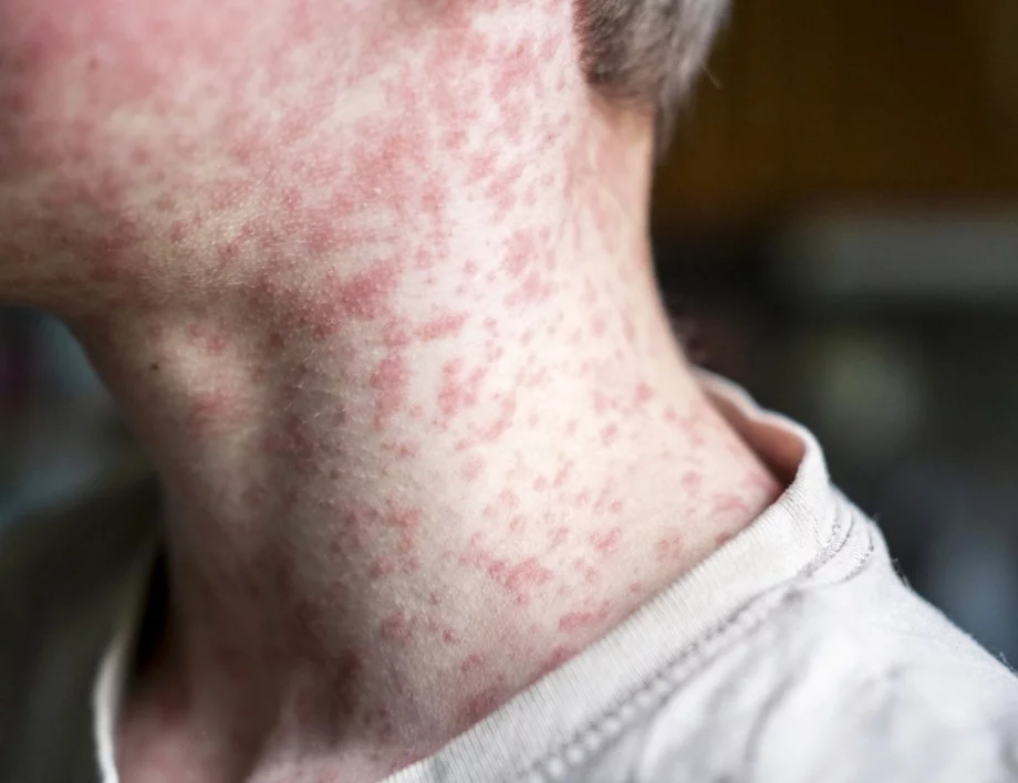 С разглезеност и глупост: Пълен назад към епидемиите