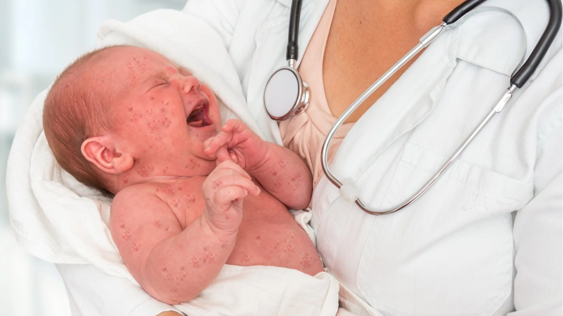 Проф. Тодор Кантарджиев каза истината за връзката между ваксината срещу морбили и аутизма