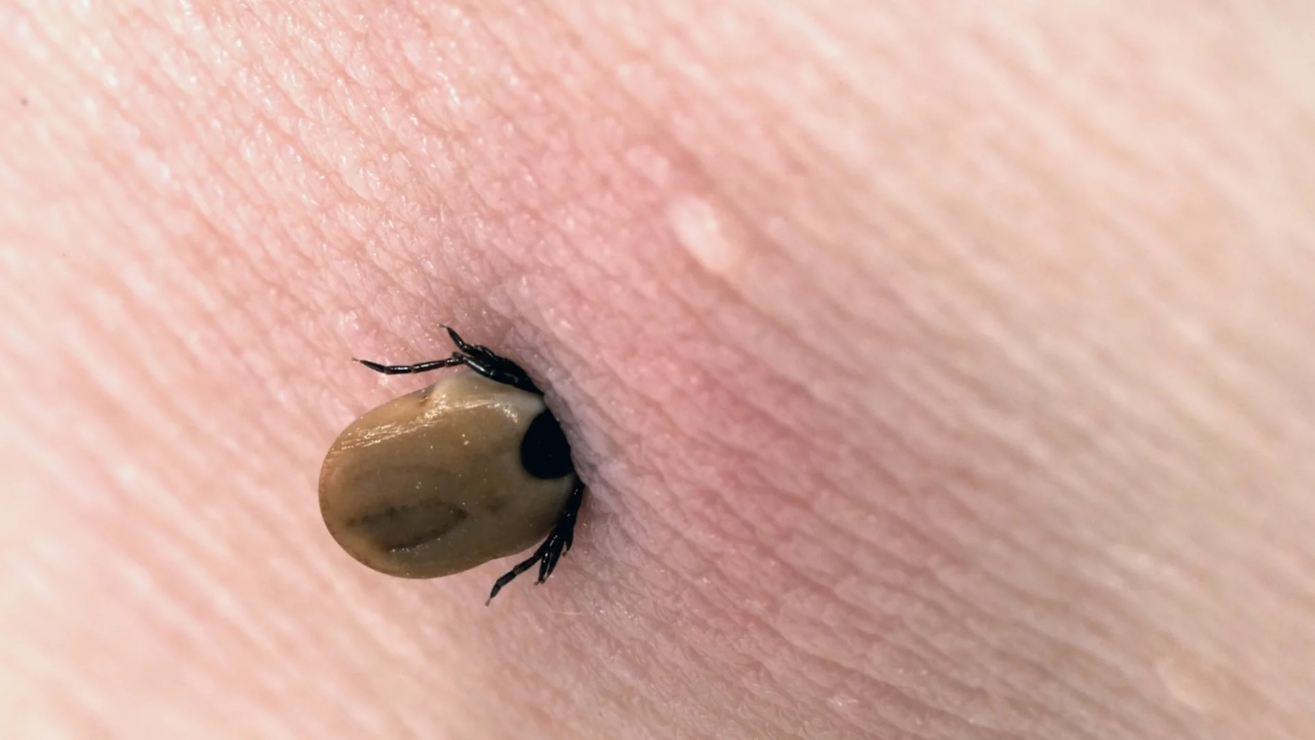 Най-добрият начин да се предпазите от ухапвания от кърлежи